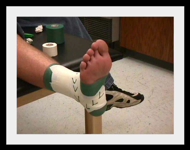 How To Tape An Ankle
