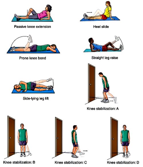 mcl injury recovery, mcl knee rehab, mcl rehab exercises, mcl knee injury rehab, mcl rehab