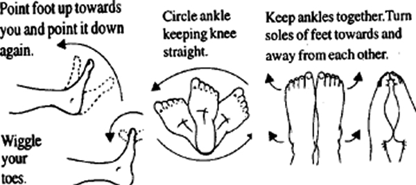 ANKLE EXERCISES ankle sprain treatment, ankle injury rehab, treating sprained ankle, soccer ankle recovery