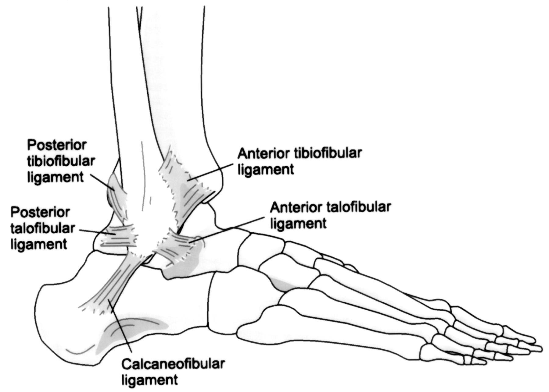 ankle injury, ankle sprain, sprained ankle, twisted ankle, soccer injury ankle